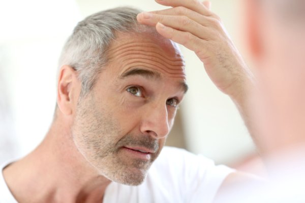 Hair Loss Linked to Lifestyle, Study Shows - Skin ...